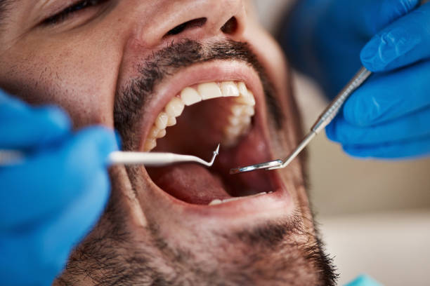 Best Emergency Tooth Extraction  in Shelburn, IN